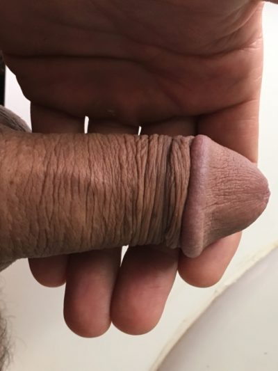 tiny dick pindick loser rate my penis