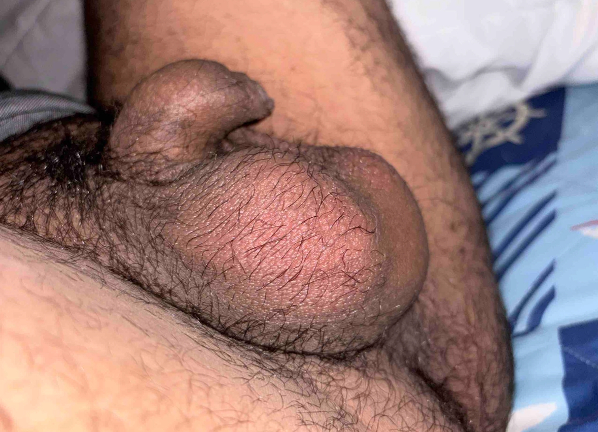 my pathetic wiener