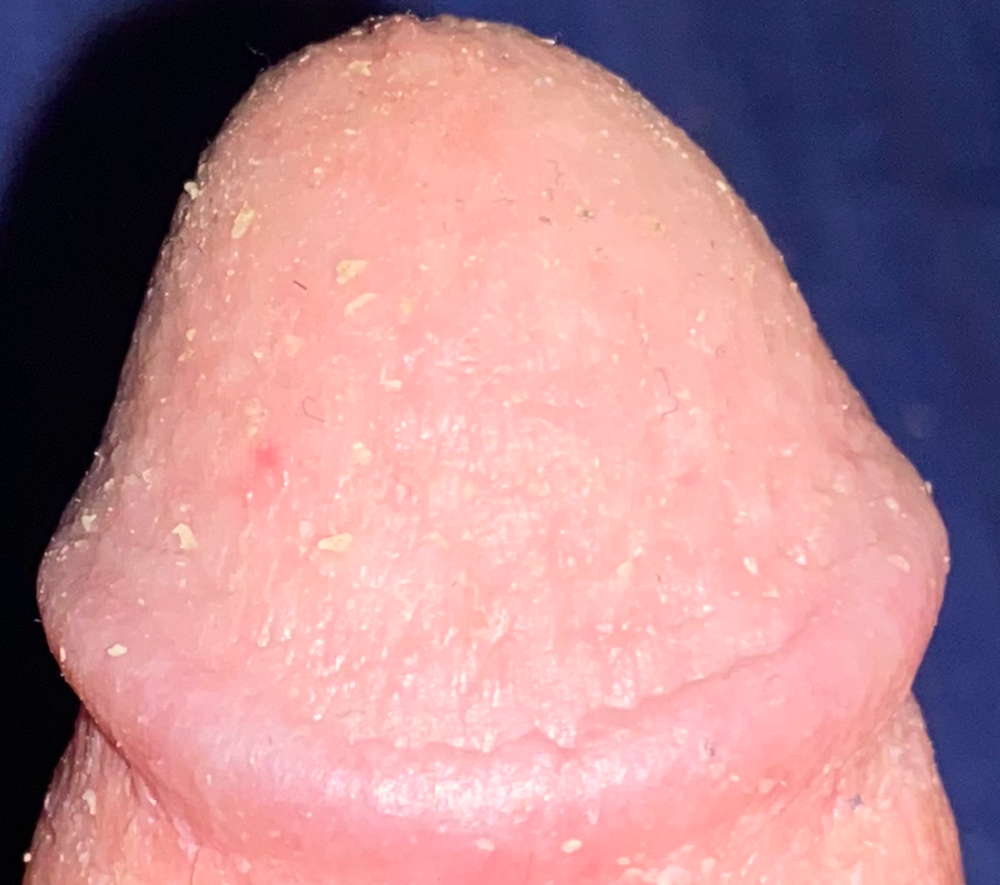 my french small head